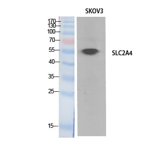 SLC2A4 / GLUT-4 Antibody