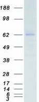 Human CDK17 / PCTK2 / PCTAIRE2 Protein (Recombinant Myc-DDK (Flag))