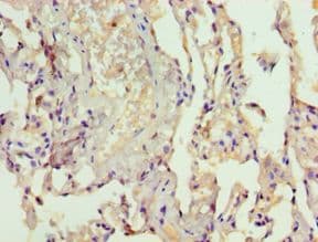 Polyclonal Rabbit anti-Human LAMTOR3 / MP1 Antibody (aa1-124, IHC)
