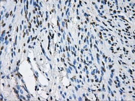 LOX / Lysyl Oxidase Antibody (clone OTI8G5)