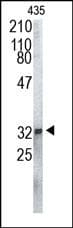 Polyclonal Rabbit anti-Human Proteasome 20S Antibody (WB)