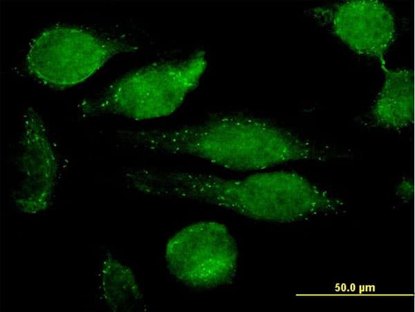 GRN / Granulin Antibody (clone 1F5)