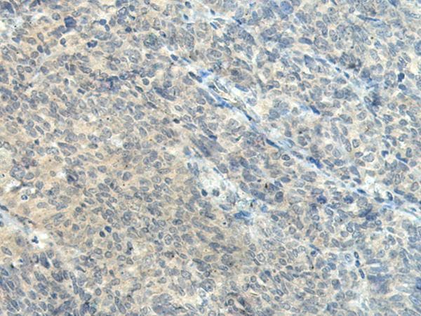 CTDP1 / FCP1 Antibody