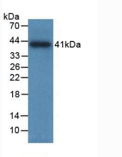TPSAB1 / Mast Cell Tryptase Antibody (Biotin)