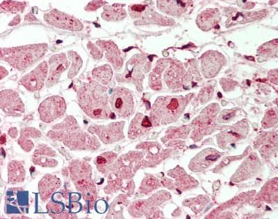 Polyclonal Rabbit anti-Mouse MXI1 / MAD2 Antibody (N-Terminus, IHC, WB)