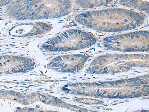 Polyclonal Rabbit anti-Human HPCAL1 / Hippocalcin-Like 1 Antibody (IHC, WB)