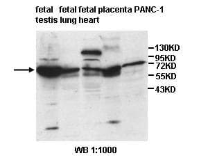 Polyclonal Rabbit anti-Human ISYNA1 Antibody (aa141-314, IHC, WB)