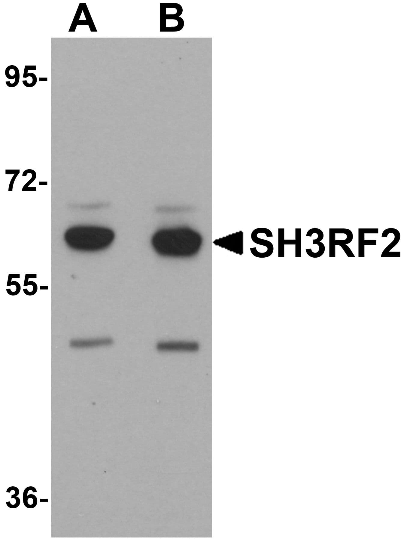 IHC-plus™ Polyclonal Rabbit anti-Human SH3RF2 Antibody (IHC, IF, WB)