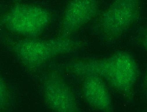 TUBB2A / Tubulin Beta 2A Antibody (clone OTI3B7)