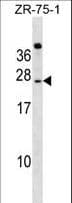 Polyclonal Rabbit anti-Human IGSF6 Antibody (aa69-97, WB)