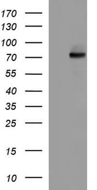 Monoclonal Mouse anti-Human ALB / Serum Albumin Antibody (clone OTI3A10, aa19-609, WB)