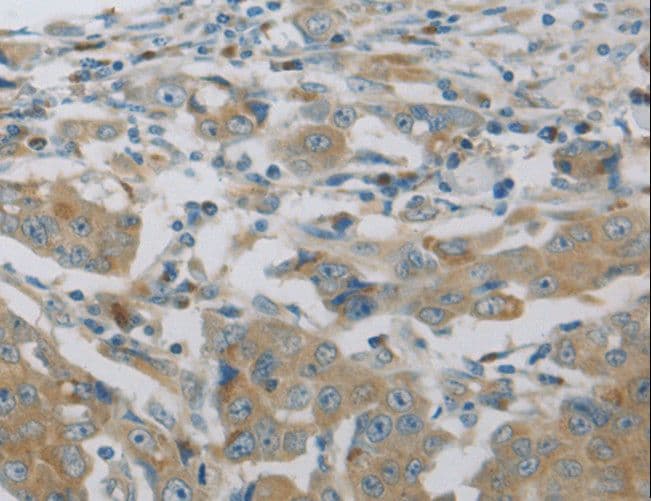 MAP2K6 / MEK6 / MKK6 Antibody