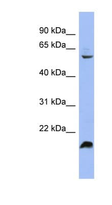 Polyclonal Rabbit anti-Human SRSF4 / SFRS4 Antibody (aa395-444, IHC, WB)