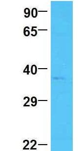 SCN4 / G6PC3 Antibody (aa86-135)