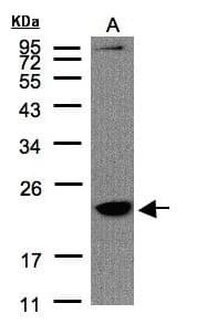 TMEM147 Antibody (aa37-131)