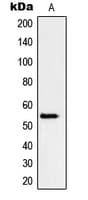 Polyclonal Rabbit anti-Human Peripherin Antibody (C-Terminus, WB)