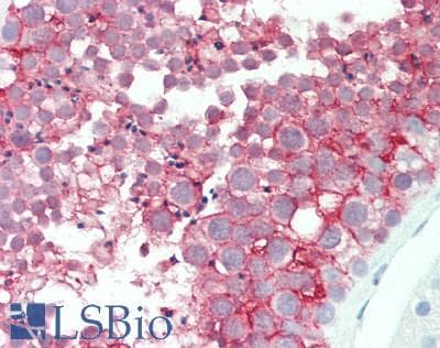 VSIG1 Antibody (aa293-322)