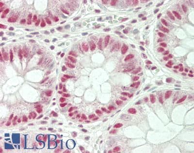 IHC-plus™ Polyclonal Rabbit anti-Human SKIV2L2 Antibody (IHC, WB)