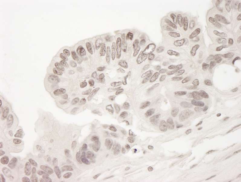 CRTC2 / TORC2 Antibody (aa300-350)