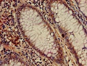 c-Met Antibody