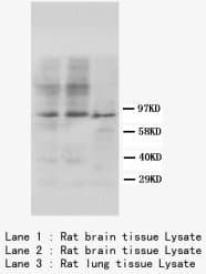 Polyclonal Rabbit anti-Mouse ADAMTS4 Antibody (Sepharose, C-Terminus)