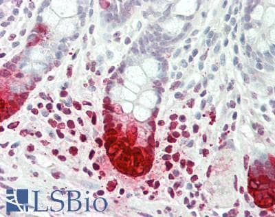 REG3A Antibody (aa40-164)