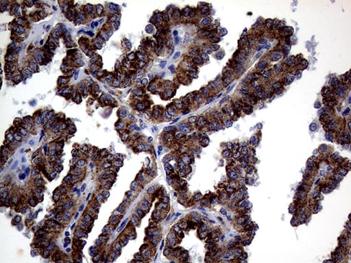 Monoclonal Mouse anti-Human CTSL / Cathepsin L Antibody (clone OTI2H2, IHC, WB)