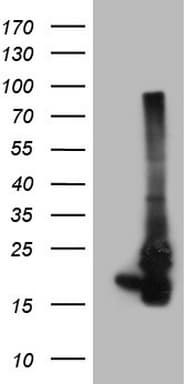 Monoclonal Mouse anti-Human NDUFB11 Antibody (clone OTI2E10, Carrier-free, aa30-163, WB)