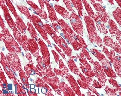 IHC-plus™ NDUFA4 Antibody (10-90 aa, C-terminal)