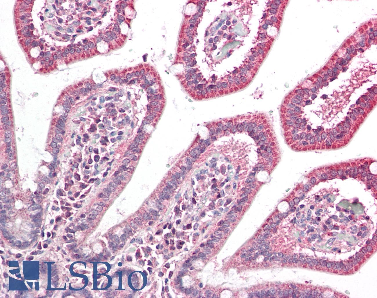 IHC-plus™ HMG-CoA Reductase / HMGCR Antibody