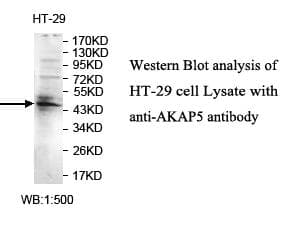 AKAP5 / AKAP79 Antibody (aa171-417)