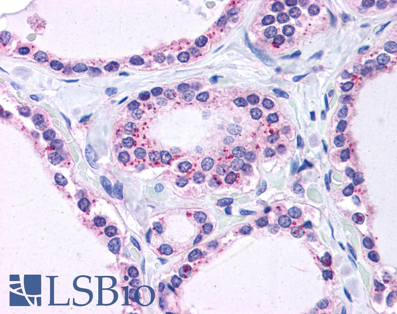 IHC-plus™ RPL22 / Ribosomal Protein L22 Antibody (aa106-119)
