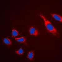 CLDN5 / Claudin 5 Antibody (C-Terminus)