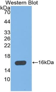 MBL2 / Mannose Binding Protein Antibody (aa129-244)