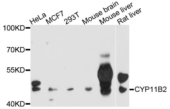 Polyclonal Rabbit anti-Human CYP11B2 / Aldosterone Synthase Antibody (WB)
