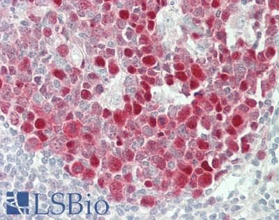 IHC-plus™ RECQL4 Antibody (C-Terminus)