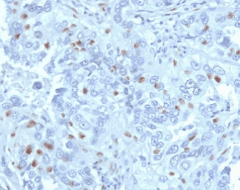 CCNA2 / Cyclin A2 Antibody (clone CNA2-1)