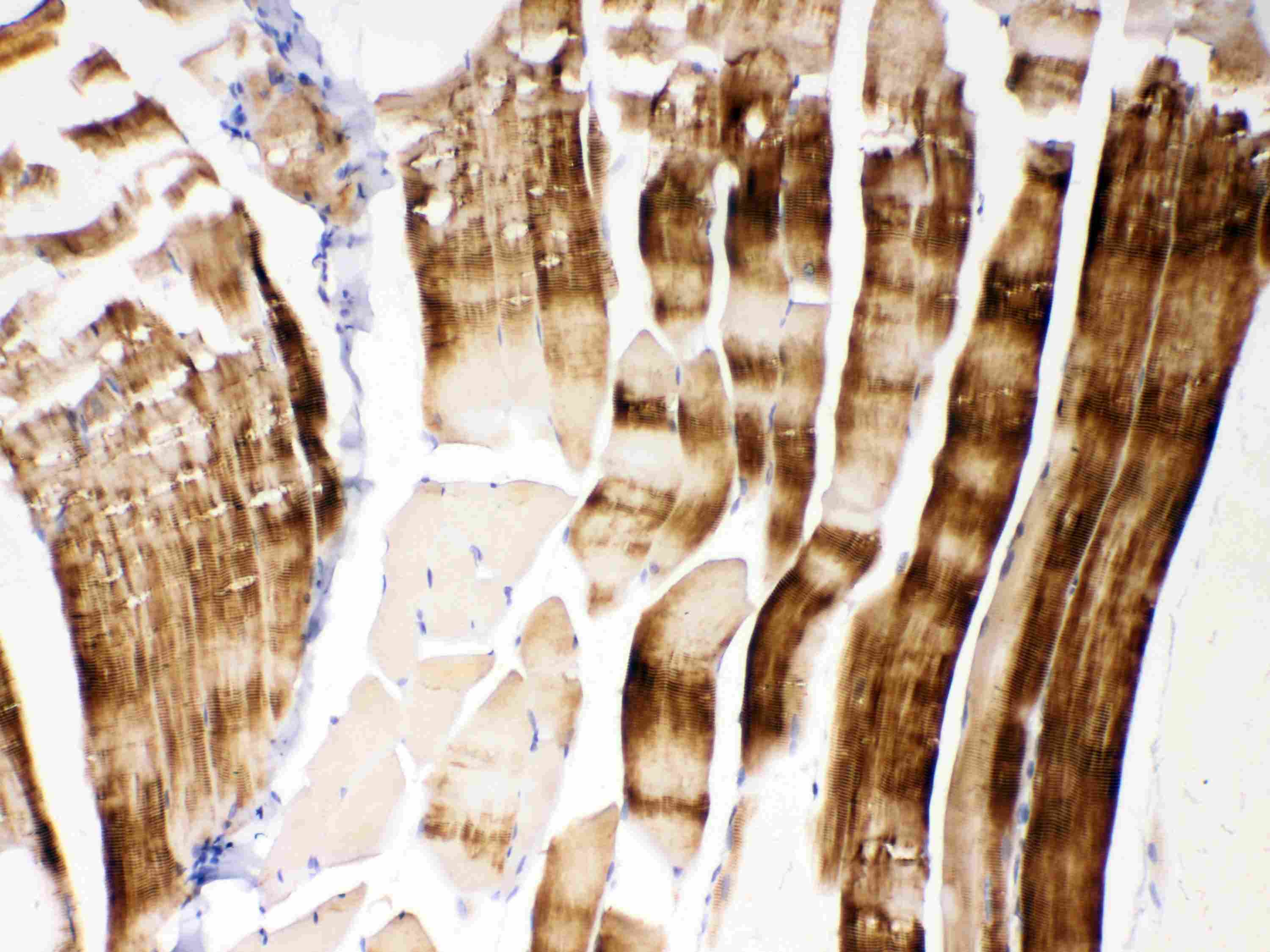 ACTN3 Antibody