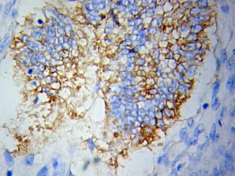 Polyclonal Rabbit anti-Human TBRG4 Antibody (IHC, WB)