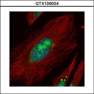 Polyclonal Rabbit anti-Human UTP6 Antibody (aa213-597, IHC, WB)