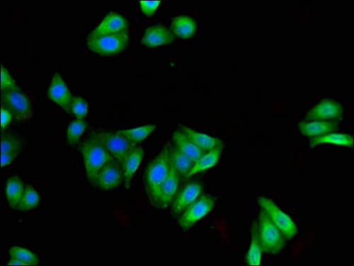 Polyclonal Rabbit anti-Human FILIP1 Antibody (IHC, IF)