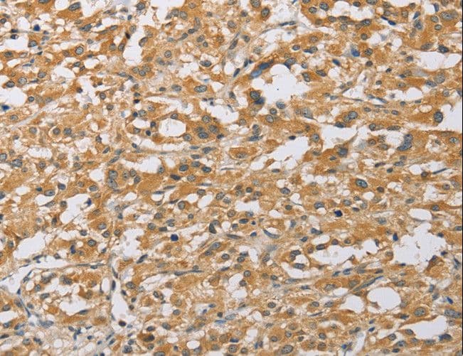 Polyclonal Rabbit anti-Human ARHGEF1 Antibody (IHC)