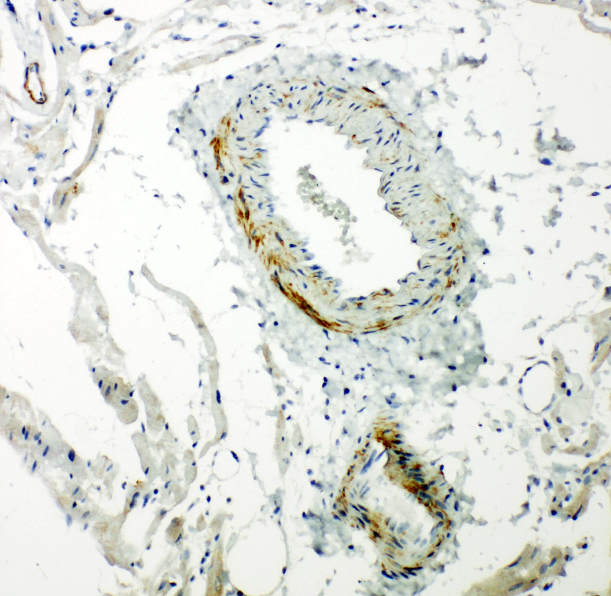 Polyclonal Rabbit anti-Human CAV2 / Caveolin 2 Antibody (aa1-17, IHC, WB)