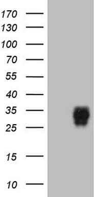 Adiponectin Antibody (aa19-244, clone OTI2G8)