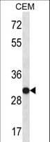 SNRPA / U1A Antibody (aa83-111)