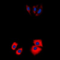 MARK2 Antibody (N-Terminus)