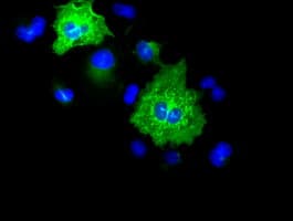 Monoclonal Mouse anti-Human KRT8 / CK8 / Cytokeratin 8 Antibody (clone OTI1B9, IF, WB)
