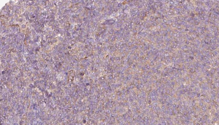 Polyclonal Rabbit anti-Human P4HA1 Antibody (IHC, IF, WB)
