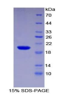 Human CENPE Protein (Recombinant His-T7)