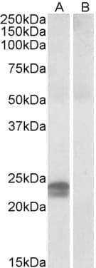 IHC-plus™ HMGIY / HMGA1 Antibody (aa9-21)